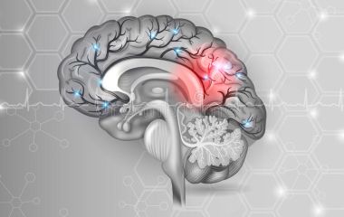 Ухудшение памяти, что делать?